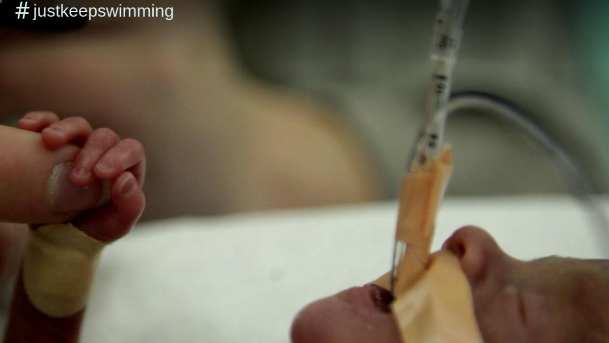 #JustKeepSwimming: mira el video de la inspiradora historia de un bebé p...