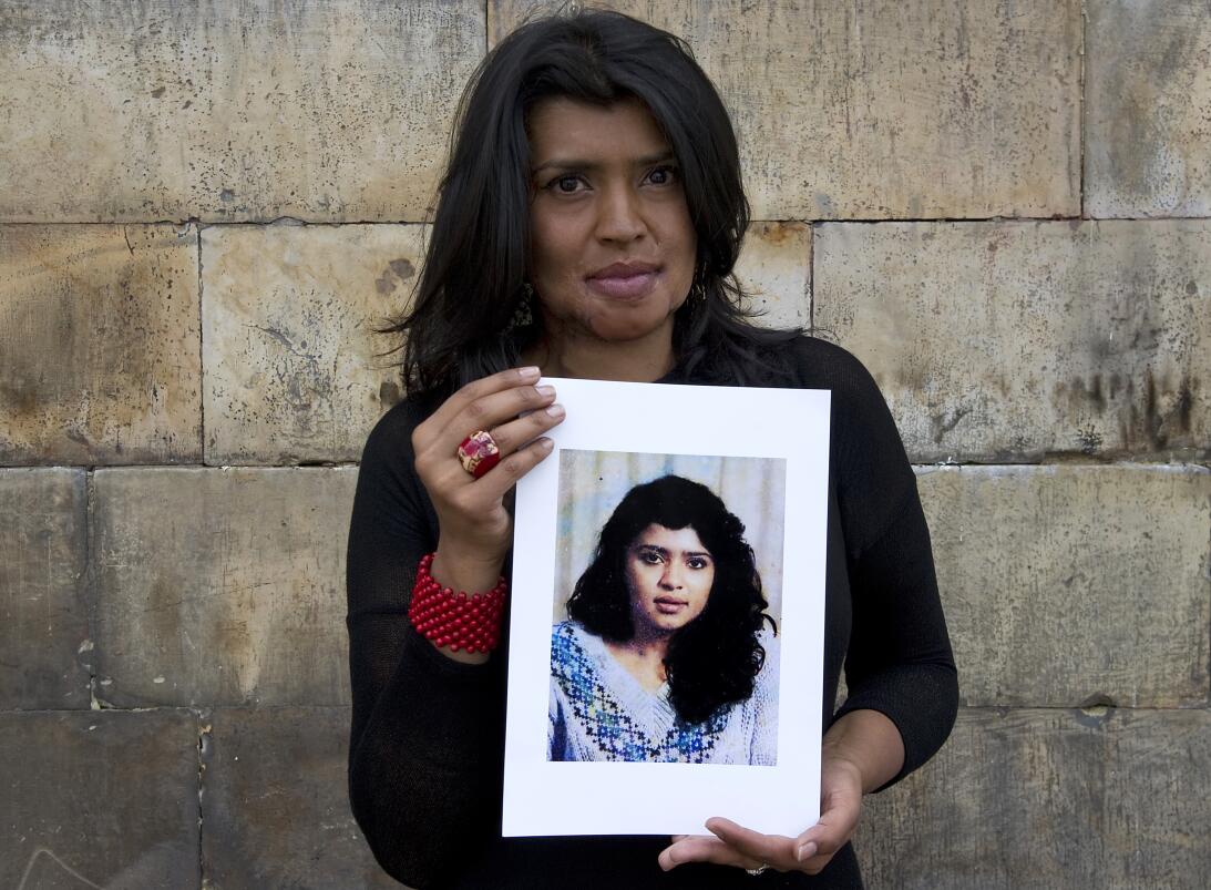 Gina se ha sometido ya a más de 28 cirugías y 70 procedimientos para rec...