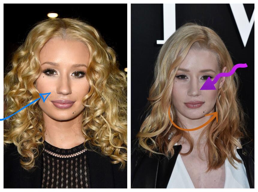 iggye