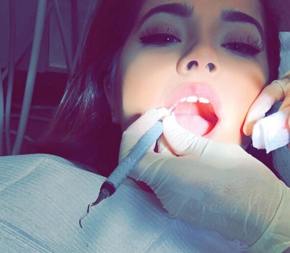 Resultado de imagen para becky g dientes